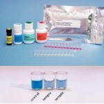 Verotoxin_Test_KIts_for_Histamine